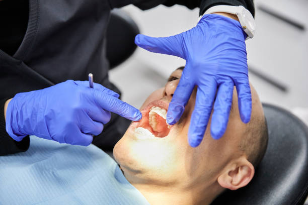 Best Broken or Chipped Tooth Repair in Falling Waters, WV